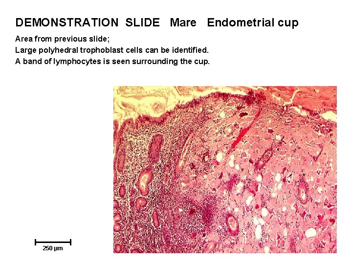 DEMONSTRATION SLIDE Mare Endometrial cup Area from previous slide; Large polyhedral trophoblast cells can