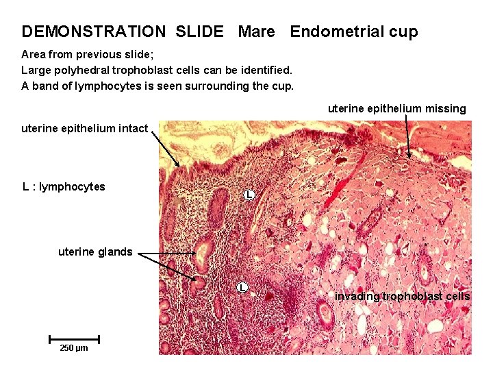 DEMONSTRATION SLIDE Mare Endometrial cup Area from previous slide; Large polyhedral trophoblast cells can