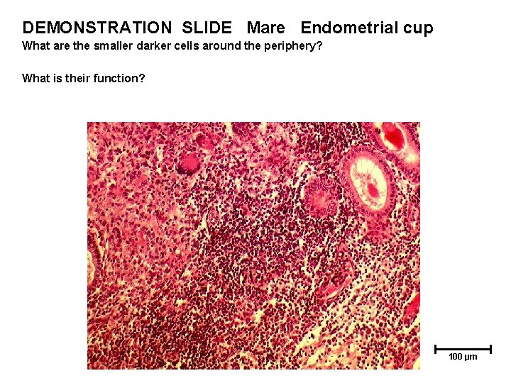 DEMONSTRATION SLIDE Mare Endometrial cup What are the smaller darker cells around the periphery?