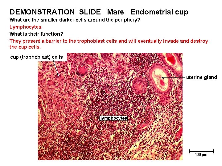 DEMONSTRATION SLIDE Mare Endometrial cup What are the smaller darker cells around the periphery?