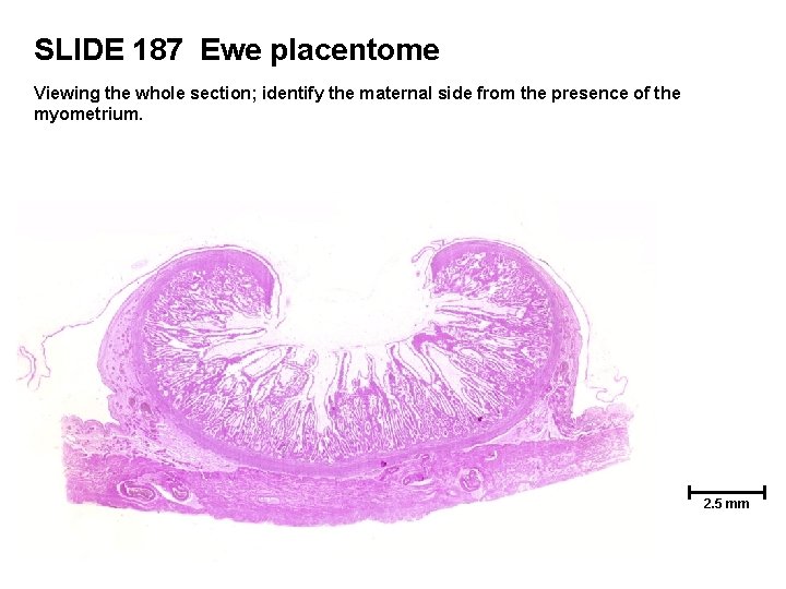 SLIDE 187 Ewe placentome Viewing the whole section; identify the maternal side from the