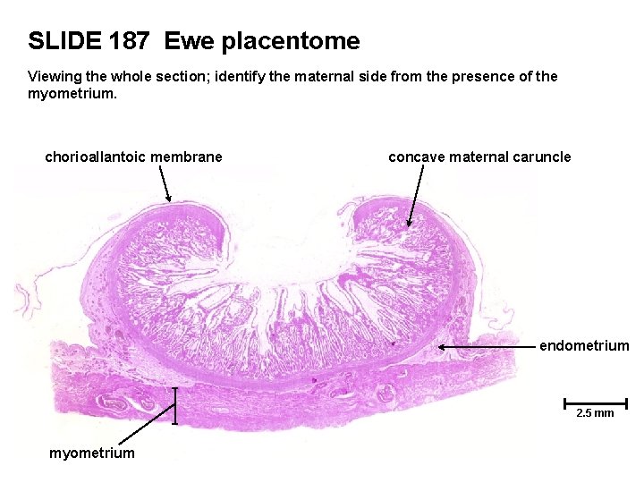 SLIDE 187 Ewe placentome Viewing the whole section; identify the maternal side from the