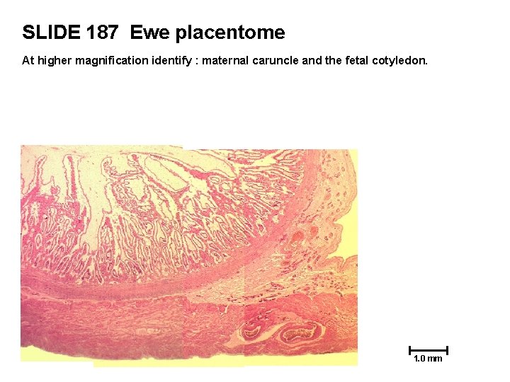 SLIDE 187 Ewe placentome At higher magnification identify : maternal caruncle and the fetal