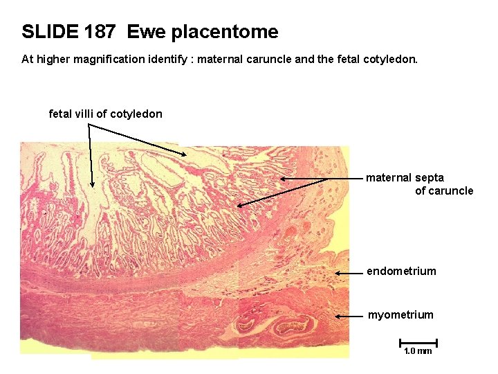 SLIDE 187 Ewe placentome At higher magnification identify : maternal caruncle and the fetal