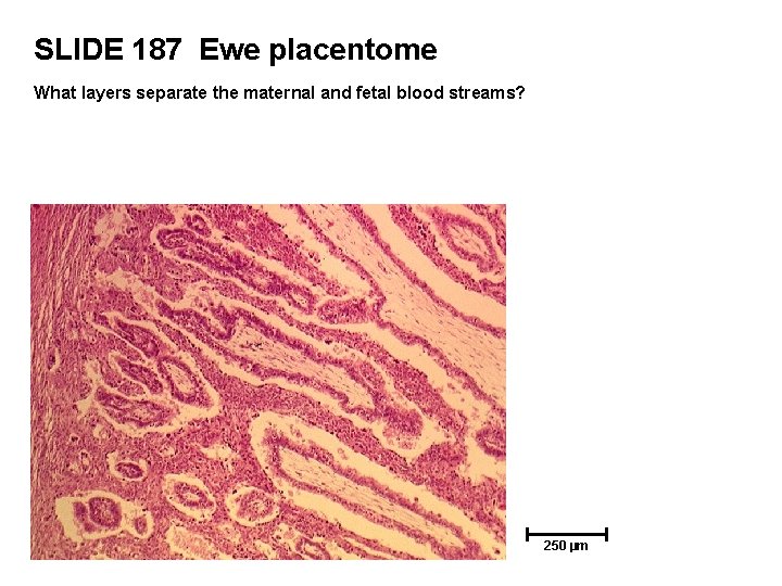 SLIDE 187 Ewe placentome What layers separate the maternal and fetal blood streams? 250