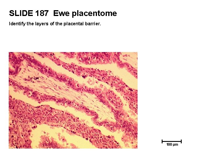 SLIDE 187 Ewe placentome Identify the layers of the placental barrier. 100 µm 