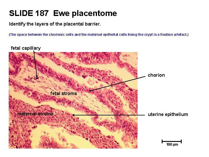 SLIDE 187 Ewe placentome Identify the layers of the placental barrier. (The space between