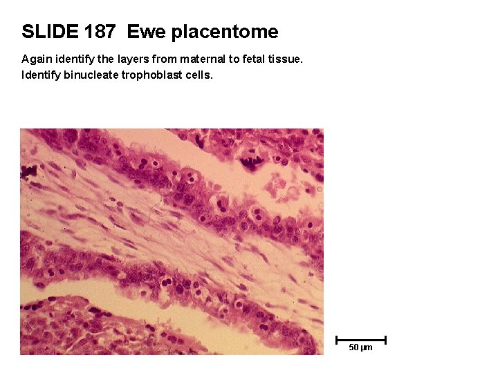 SLIDE 187 Ewe placentome Again identify the layers from maternal to fetal tissue. Identify