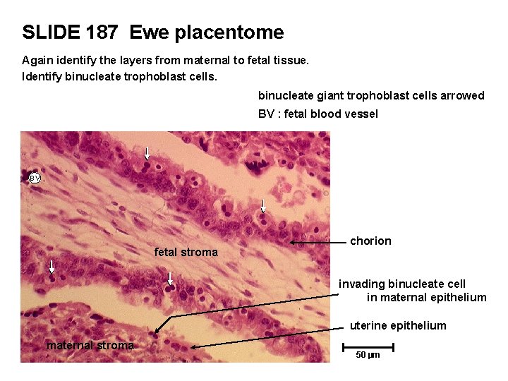 SLIDE 187 Ewe placentome Again identify the layers from maternal to fetal tissue. Identify