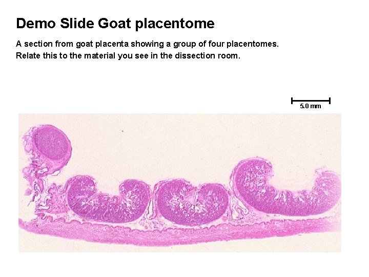 Demo Slide Goat placentome A section from goat placenta showing a group of four