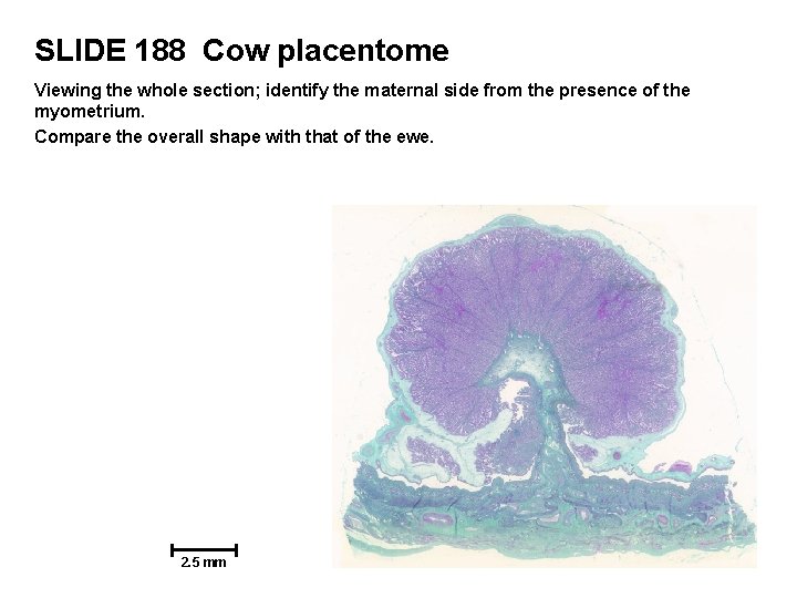 SLIDE 188 Cow placentome Viewing the whole section; identify the maternal side from the