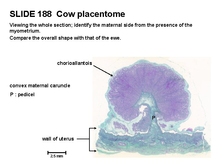 SLIDE 188 Cow placentome Viewing the whole section; identify the maternal side from the