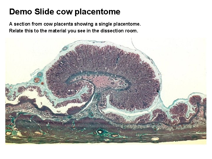 Demo Slide cow placentome A section from cow placenta showing a single placentome. Relate