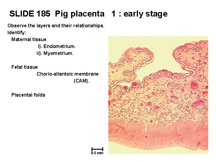 SLIDE 185 Pig placenta 1 : early stage Observe the layers and their relationships.