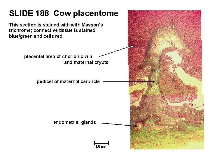 SLIDE 188 Cow placentome This section is stained with Masson’s trichrome; connective tissue is