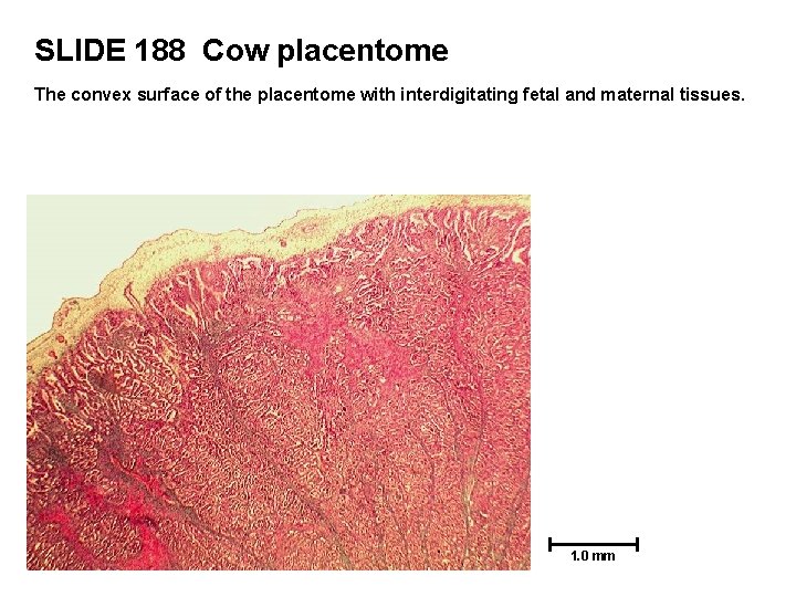 SLIDE 188 Cow placentome The convex surface of the placentome with interdigitating fetal and