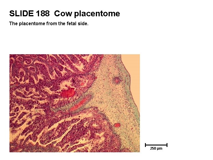 SLIDE 188 Cow placentome The placentome from the fetal side. 250 µm 