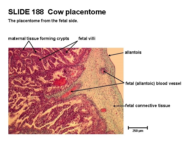 SLIDE 188 Cow placentome The placentome from the fetal side. maternal tissue forming crypts