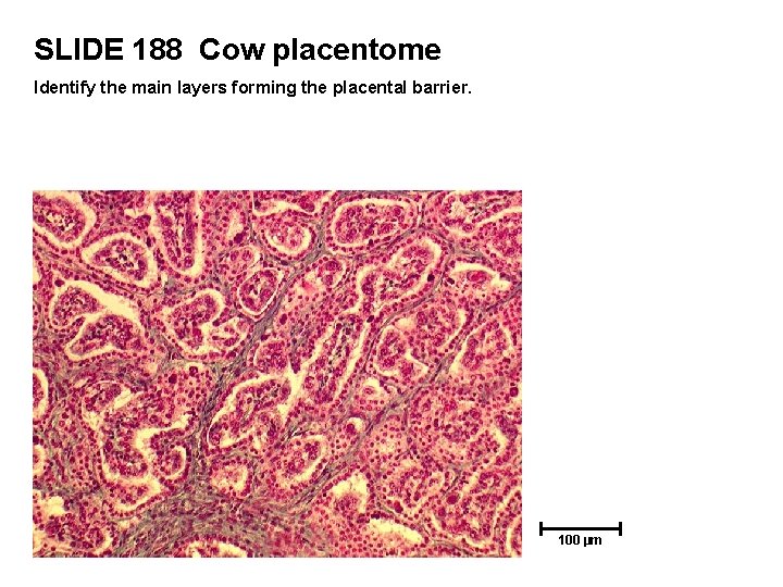 SLIDE 188 Cow placentome Identify the main layers forming the placental barrier. 100 µm
