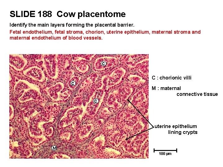 SLIDE 188 Cow placentome Identify the main layers forming the placental barrier. Fetal endothelium,