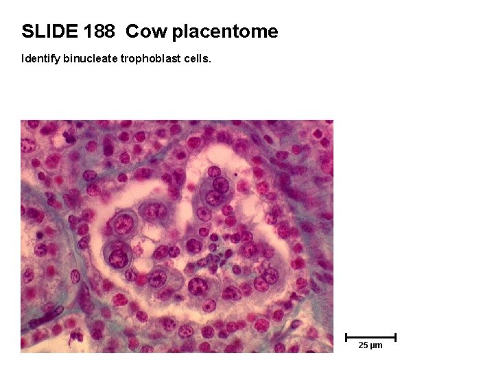 SLIDE 188 Cow placentome Identify binucleate trophoblast cells. 25 µm 