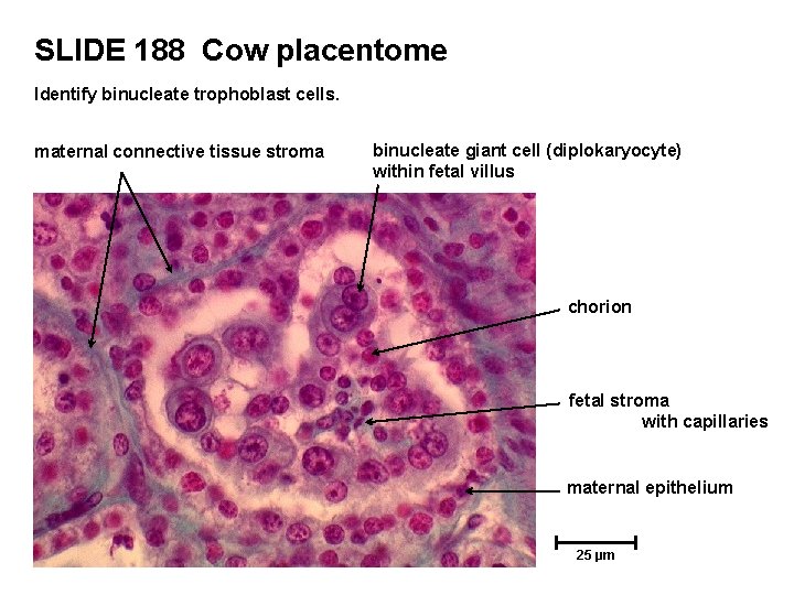 SLIDE 188 Cow placentome Identify binucleate trophoblast cells. maternal connective tissue stroma binucleate giant