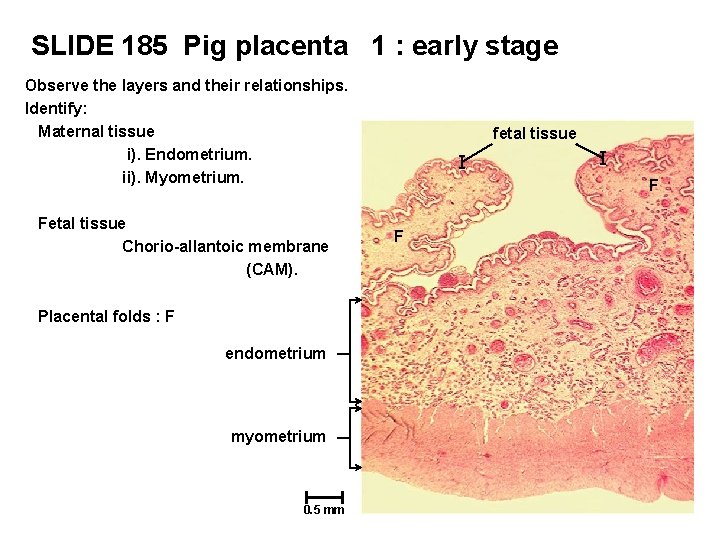 SLIDE 185 Pig placenta 1 : early stage Observe the layers and their relationships.