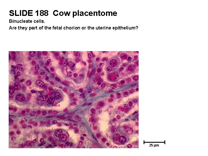 SLIDE 188 Cow placentome Binucleate cells. Are they part of the fetal chorion or