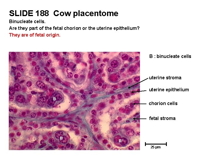 SLIDE 188 Cow placentome Binucleate cells. Are they part of the fetal chorion or