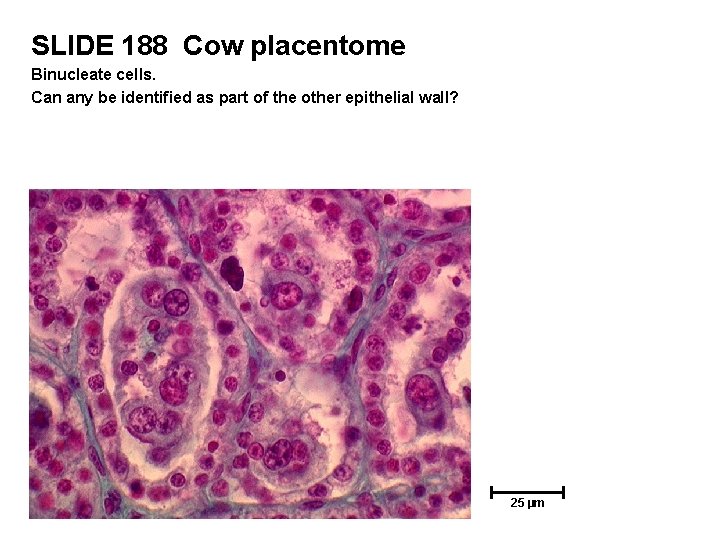 SLIDE 188 Cow placentome Binucleate cells. Can any be identified as part of the