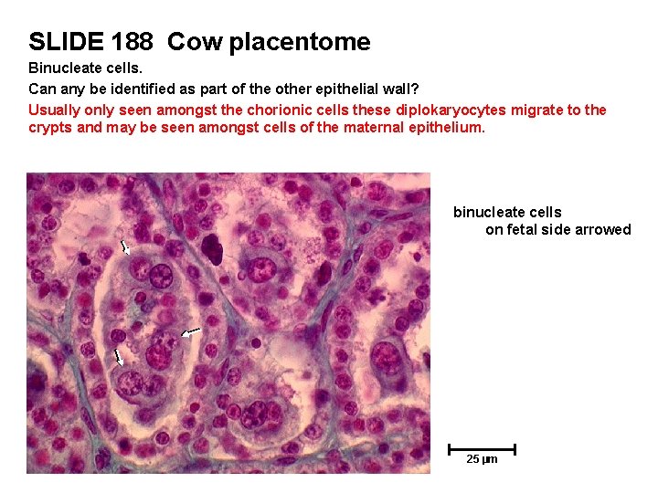 SLIDE 188 Cow placentome Binucleate cells. Can any be identified as part of the