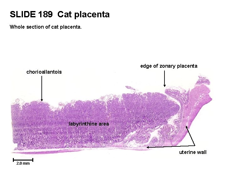 SLIDE 189 Cat placenta Whole section of cat placenta. edge of zonary placenta chorioallantois