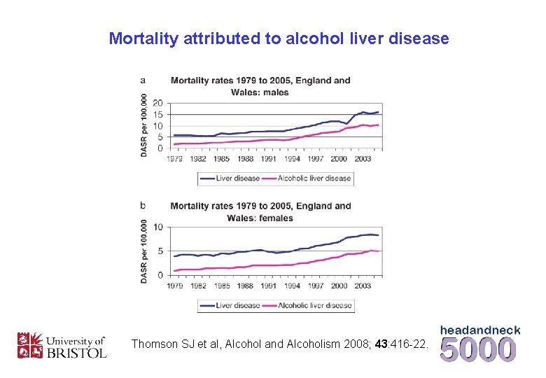 Mortality attributed to alcohol liver disease Thomson SJ et al, Alcohol and Alcoholism 2008;