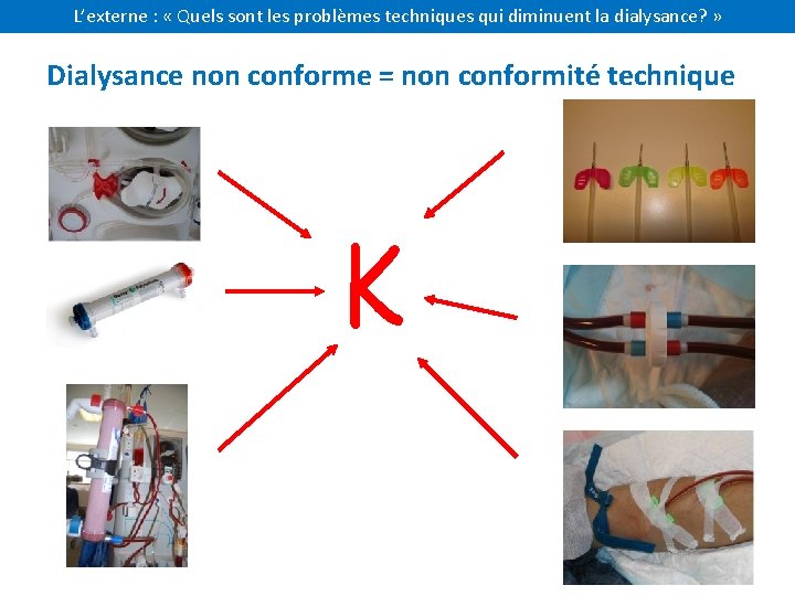 L’externe : « Quels sont les problèmes techniques qui diminuent la dialysance? » Dialysance