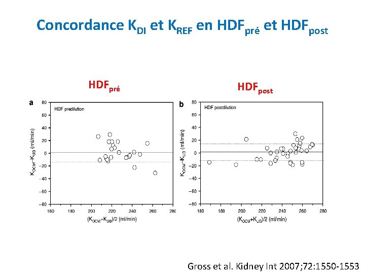 Concordance KDI et KREF en HDFpré et HDFpost HDFpré HDFpost Gross et al. Kidney
