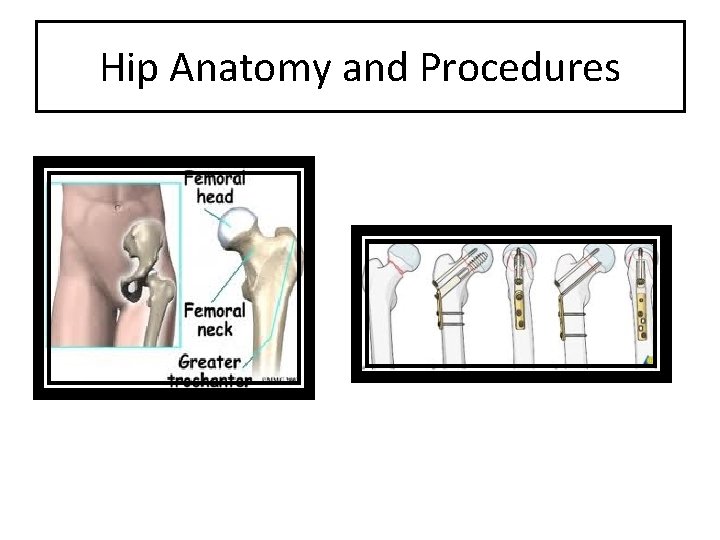 Hip Anatomy and Procedures 