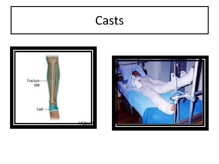 Casts 