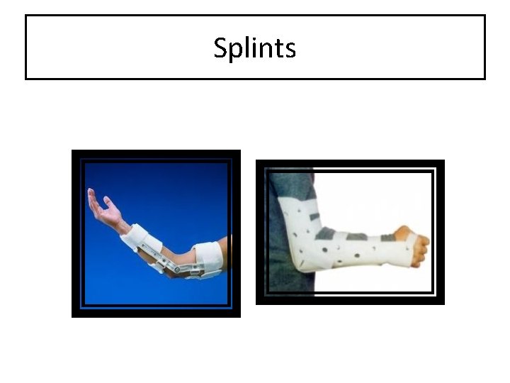 Splints 