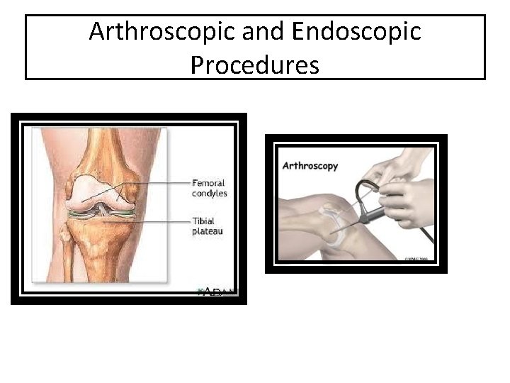 Arthroscopic and Endoscopic Procedures 