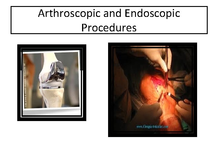 Arthroscopic and Endoscopic Procedures 