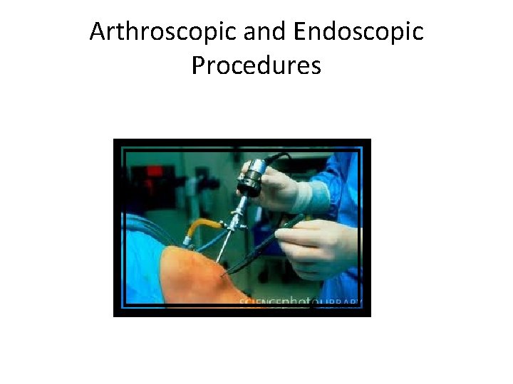 Arthroscopic and Endoscopic Procedures 