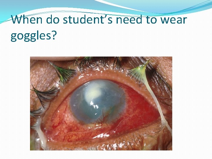 When do student’s need to wear goggles? 