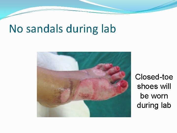 No sandals during lab Closed-toe shoes will be worn during lab 
