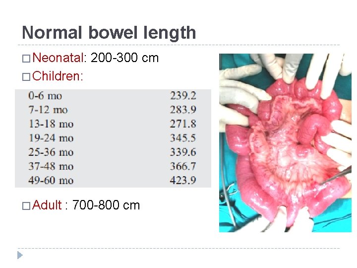 Normal bowel length � Neonatal: 200 -300 cm � Children: � Adult : 700
