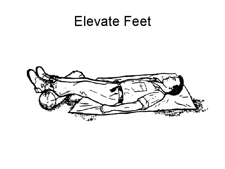 Elevate Feet 