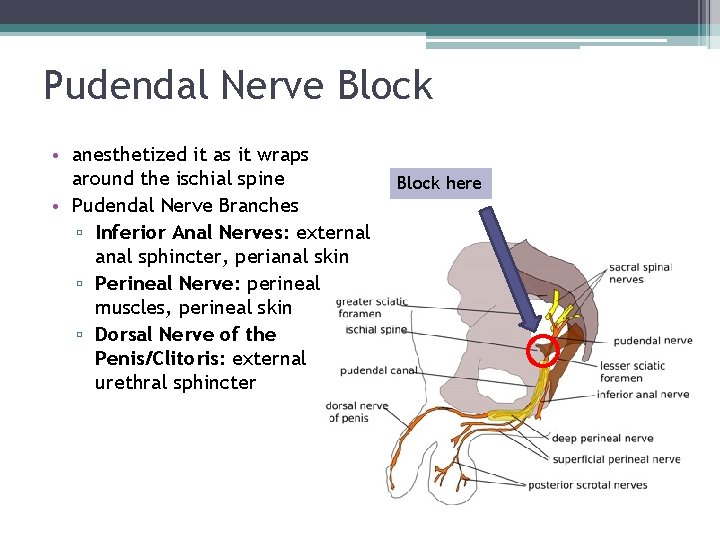 Pudendal Nerve Block • anesthetized it as it wraps around the ischial spine • Pudendal Nerve Block • anesthetized it as it wraps around the ischial spine •
