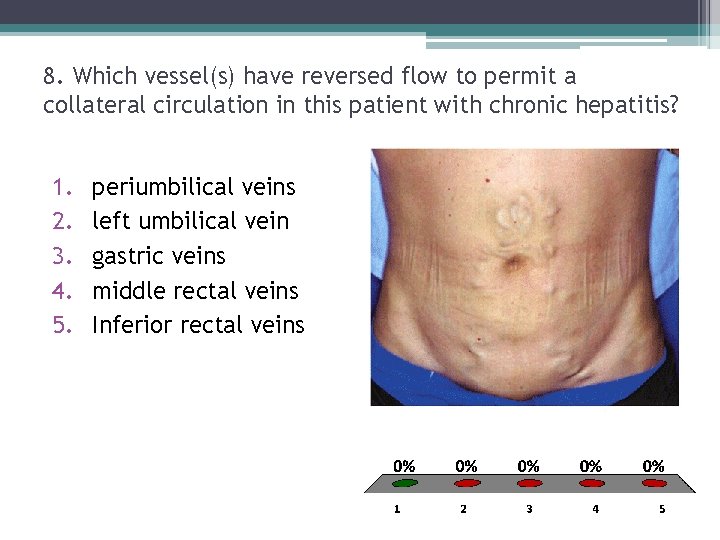 8. Which vessel(s) have reversed flow to permit a collateral circulation in this patient 8. Which vessel(s) have reversed flow to permit a collateral circulation in this patient