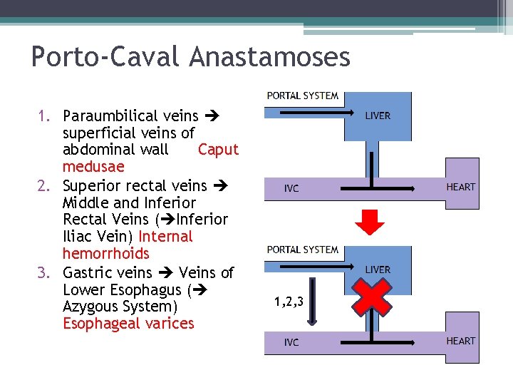 Porto-Caval Anastamoses 1. Paraumbilical veins superficial veins of abdominal wall Caput medusae 2. Superior Porto-Caval Anastamoses 1. Paraumbilical veins superficial veins of abdominal wall Caput medusae 2. Superior