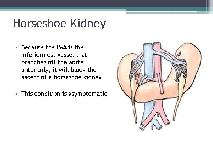 Horseshoe Kidney • Because the IMA is the inferiormost vessel that branches off the Horseshoe Kidney • Because the IMA is the inferiormost vessel that branches off the