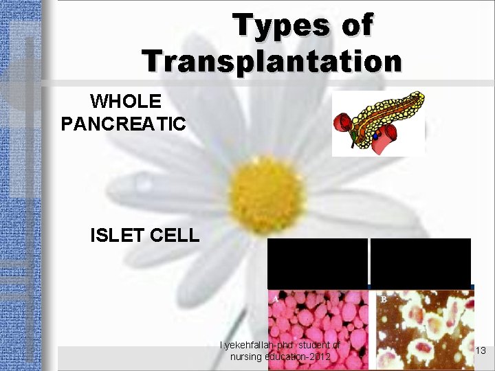 Types of Transplantation WHOLE PANCREATIC ISLET CELL l. yekehfallah-phd student of nursing education-2012 13